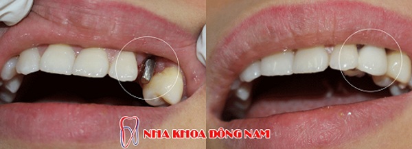 nha-khoa-dong-nam-tinhot24h